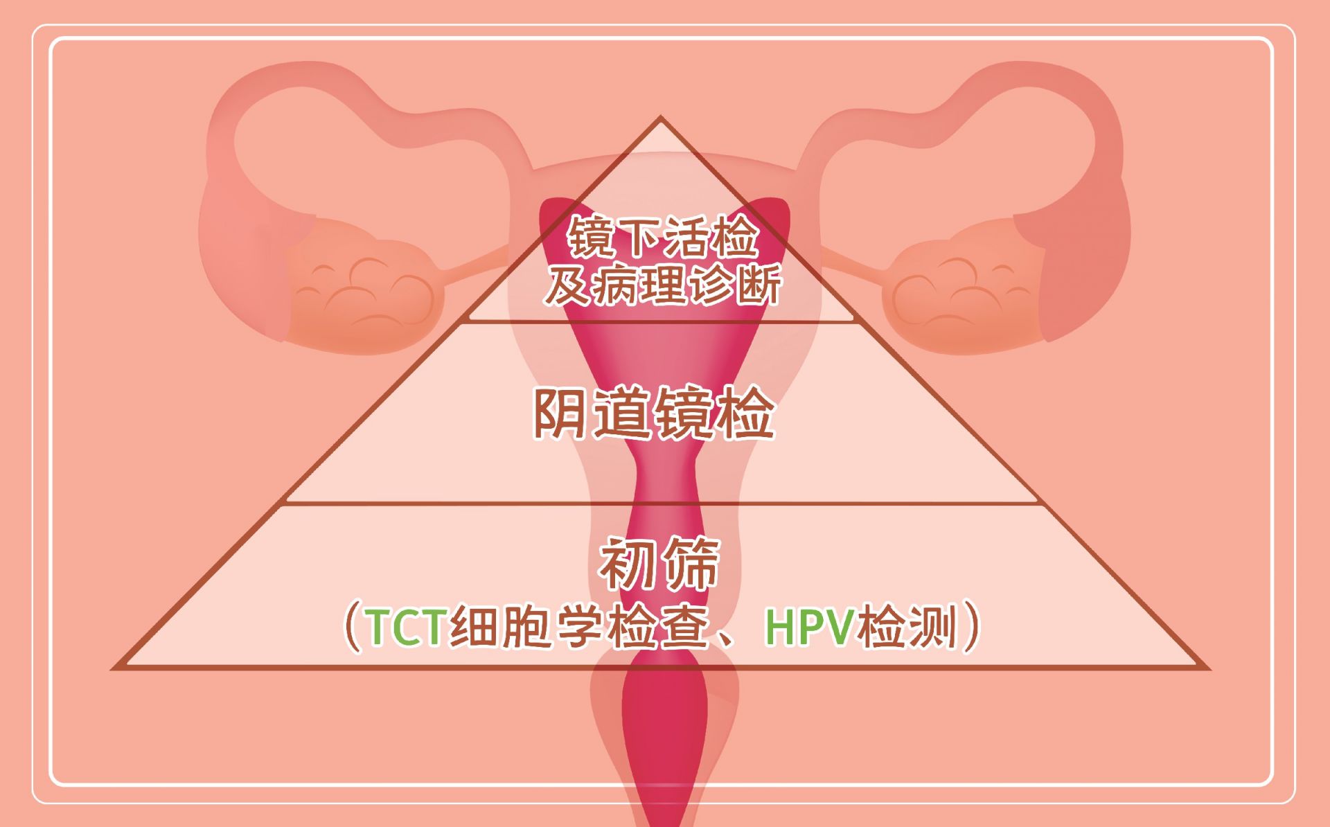 宫颈tct检查结果癌_子宫颈癌术后_宫颈癌前病变是癌吗